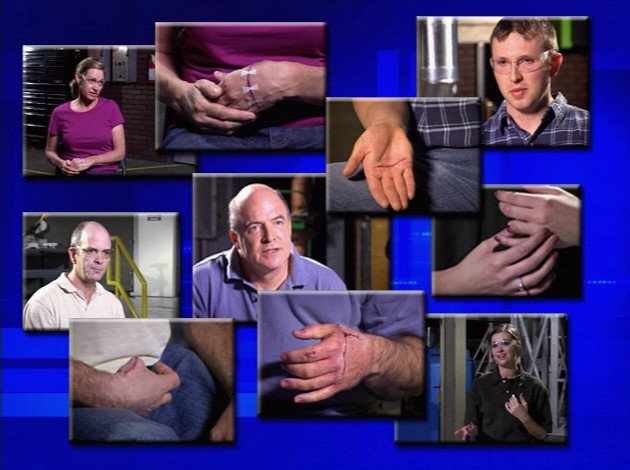 Several workers with hand injuries discussing their workplace accidents and what they learned