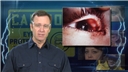 A presenter explaining an example of an eye injury caused by not following eye safety training